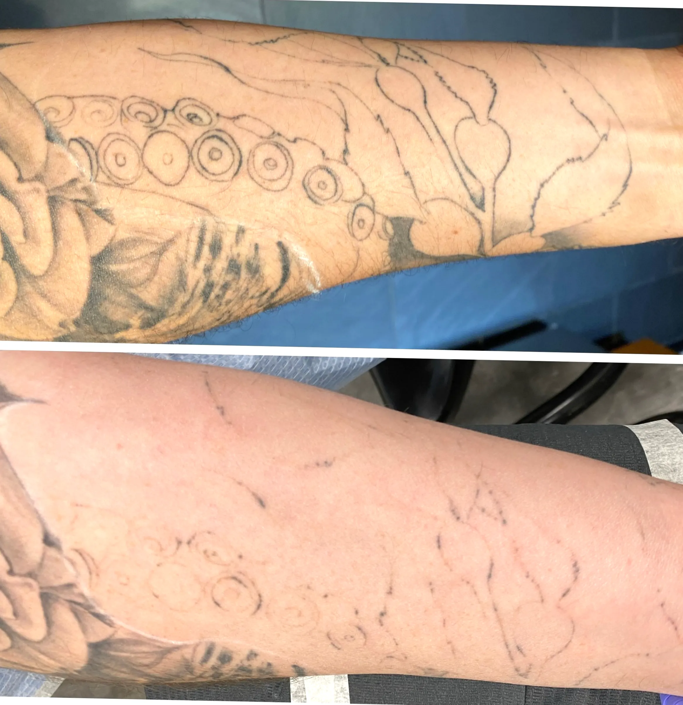countries where tattoos are illegal