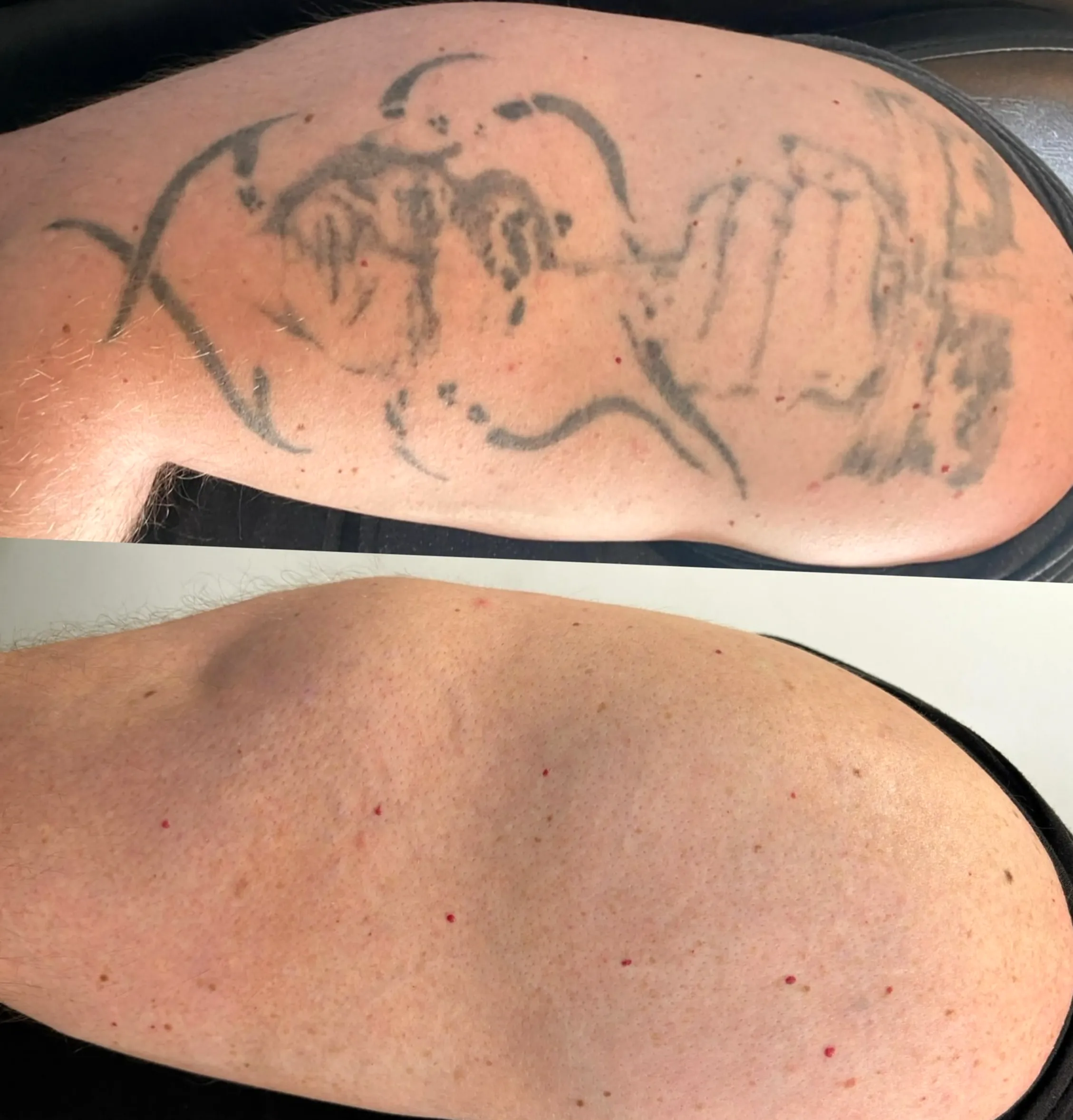 Which Country Will Not Allow Tattoos?