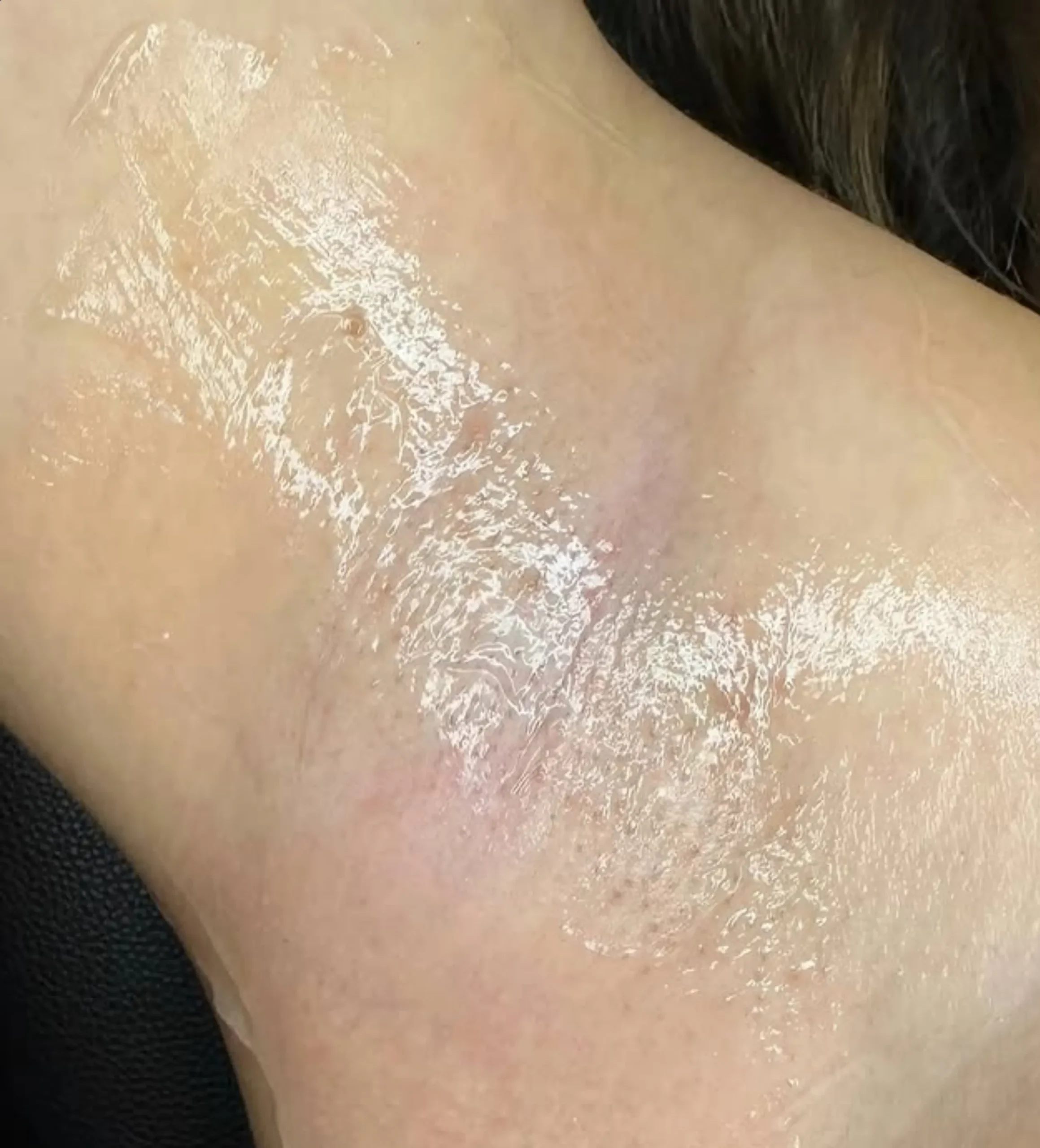 cosmetic laser qualification Australia