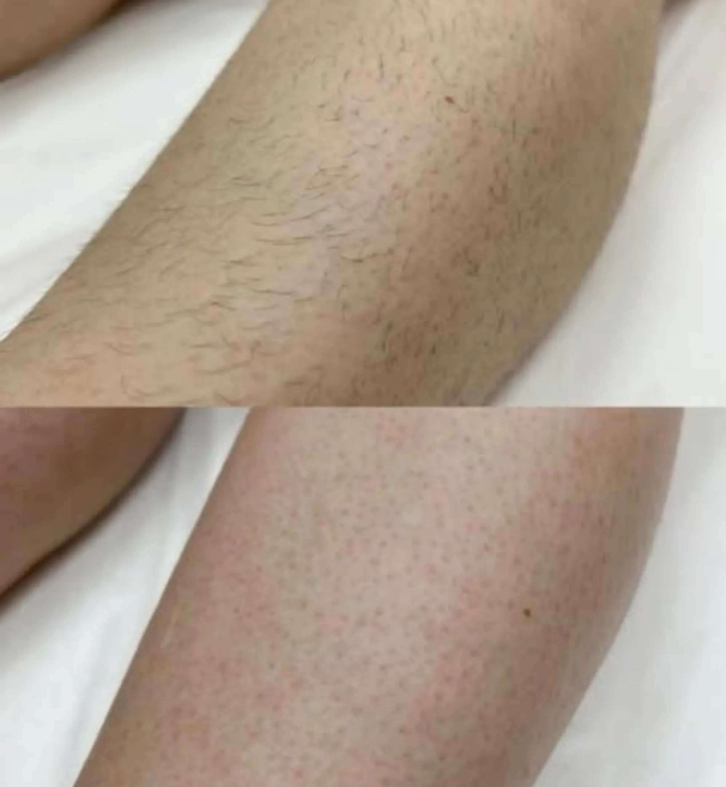 cosmetic laser training Australia